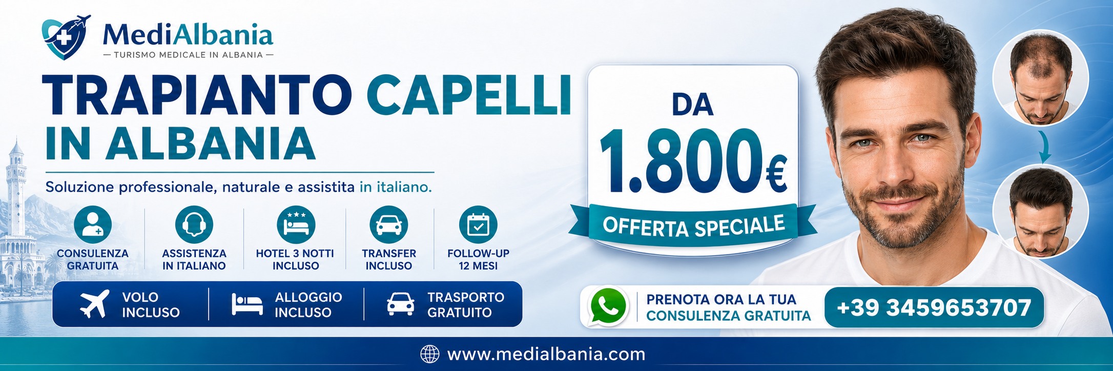 Promo Trapianto Capelli in Albania