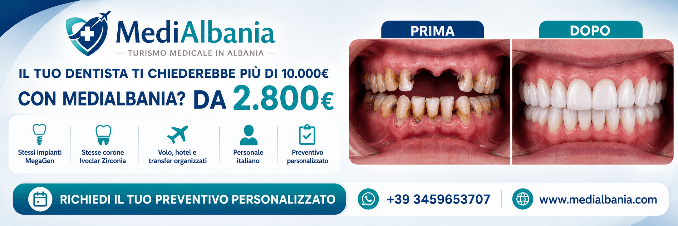 Promo arcata dentale in Albania