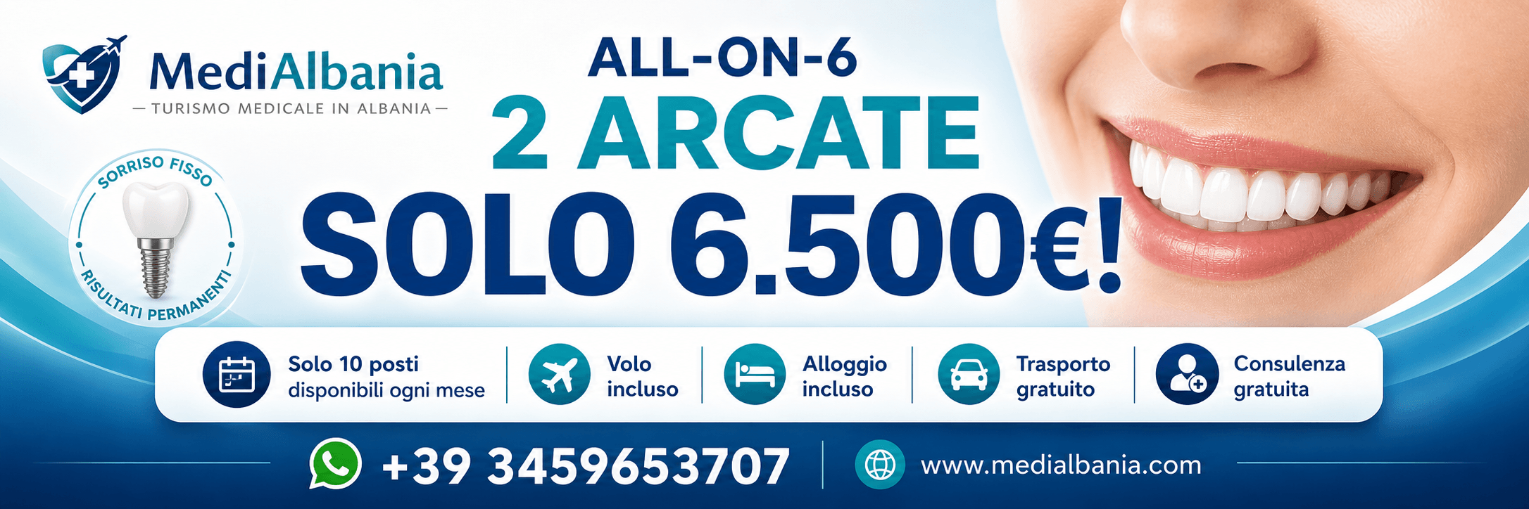 Promo arcate dentali all on 6 in Albania