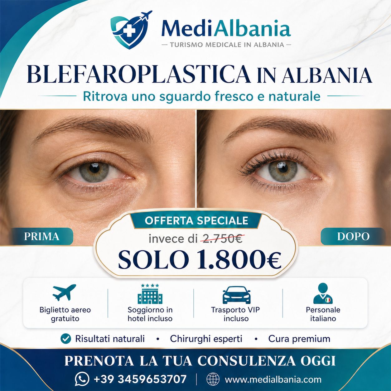 promo_blefaroplastica_in_albania