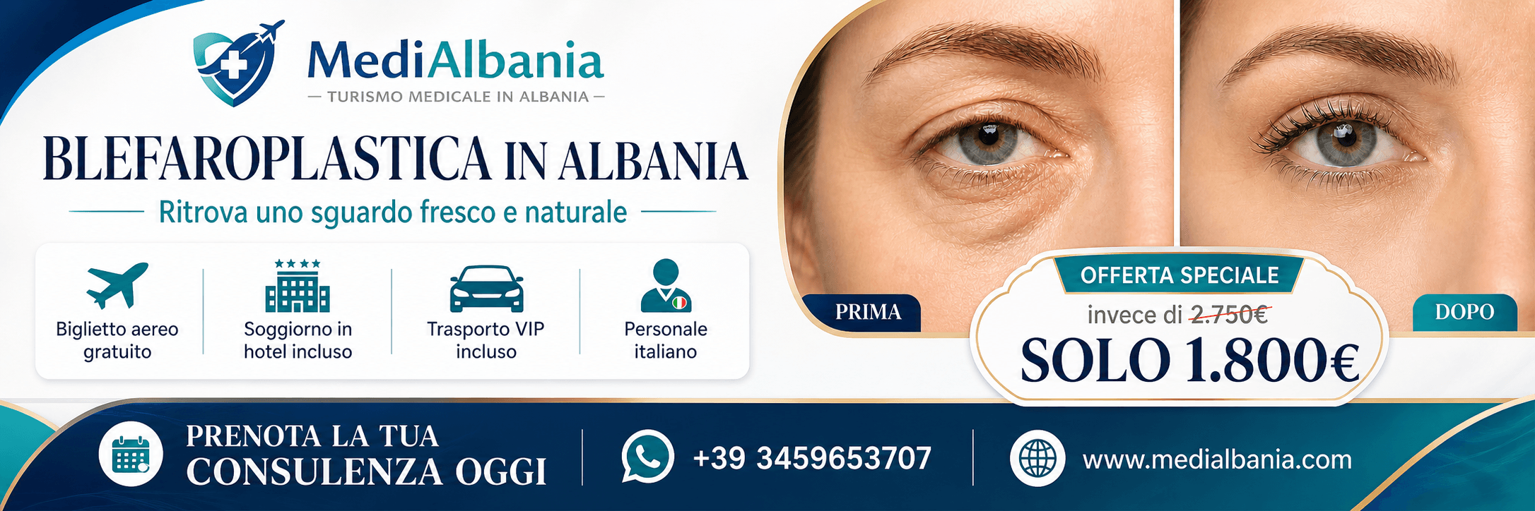Promo blefaroplastica in Albania