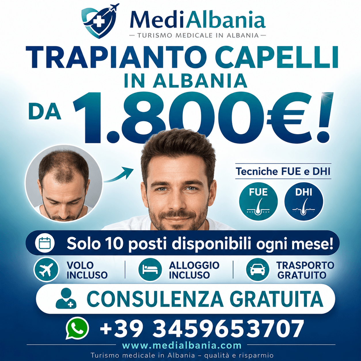 promo_trapianto_capelli_Albania_FUE-DHI